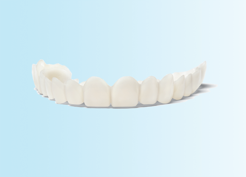 Dental clear aligner with a set of upper teeth on a gradient blue background. The aligner appears clean and smooth, representing dental care.