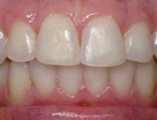 A beautiful smile with white teeth